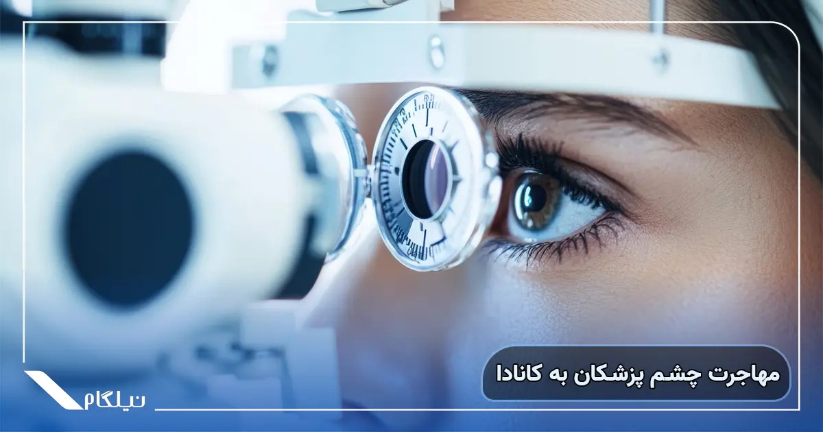 مهاجرت چشم پزشکان به کانادا